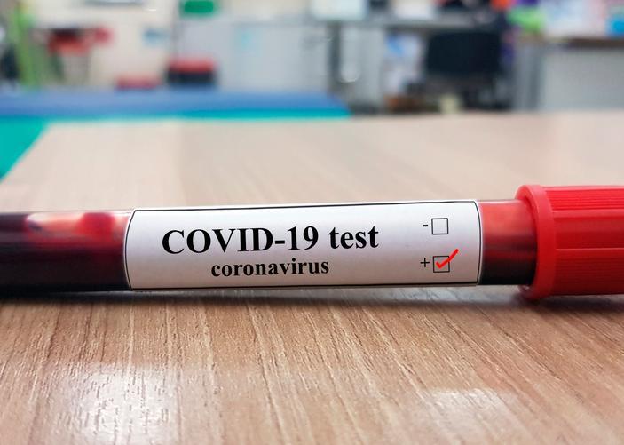Test rápido de coronavirus empezará gratis a partir de este jueves