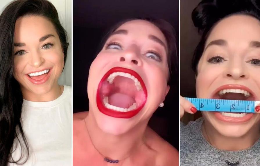 Video | La “influencer” que obtuvo el récord Guinness de la mujer con la boca más grande del mundo