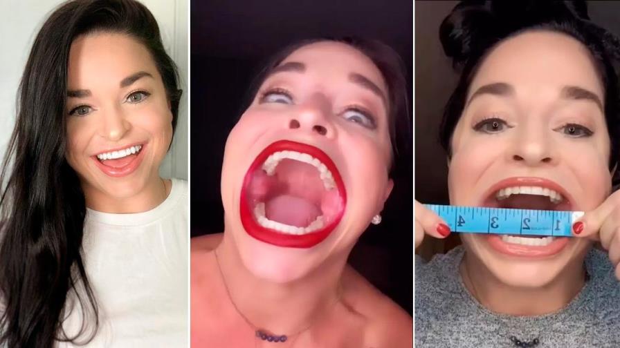 Video | La “influencer” que obtuvo el récord Guinness de la mujer con la boca más grande del mundo