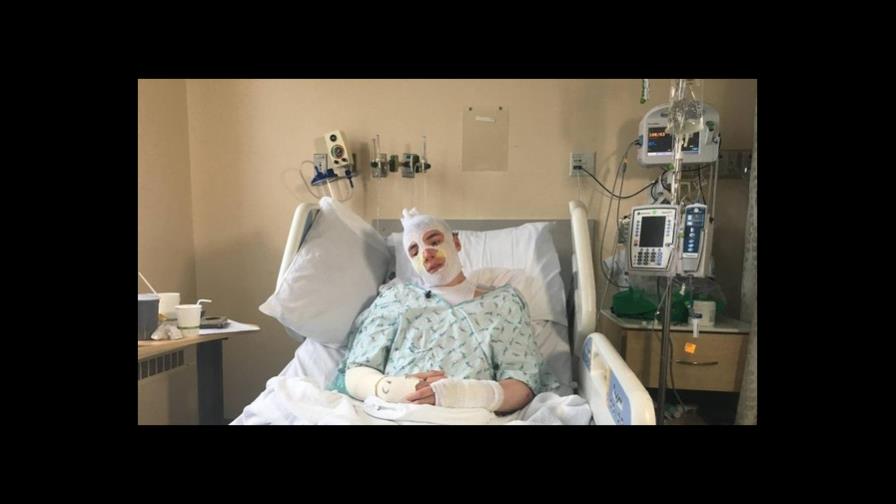 Joven sufre graves quemaduras al salvar a su sobrina de ocho años de un incendio