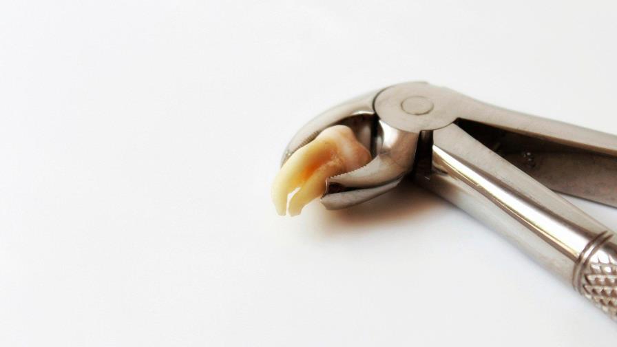 La falta de espacio para muela del juicio, inconveniente de la cara moderna