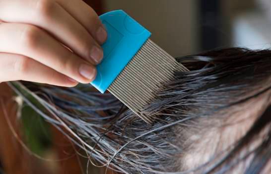 Los piojos se mueven arrastrándose, “no pueden saltar ni volar”, afirma la Biblioteca de Medicina de Estados Unidos y el médico dermatólogo, Manuel Cochón Aranda. ( SHUTTERSTOCK)