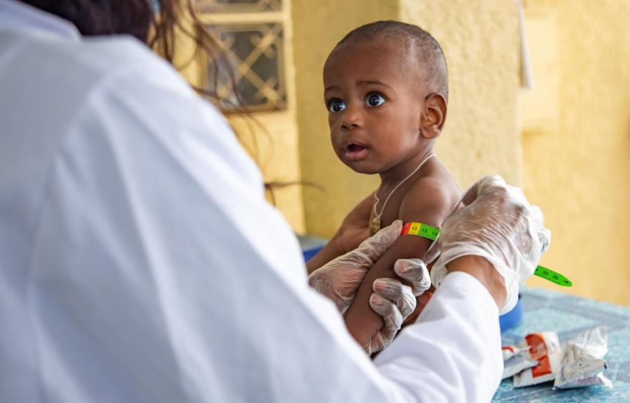 6.7 MM de niños podrían sufrir de desnutrición aguda  debido a la COVID-19, según UNICEF