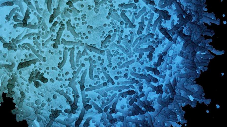 Variante británica del virus, detectada ya en ocho estados de EEUU 