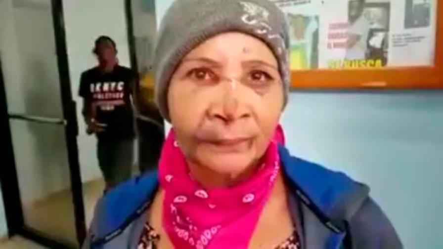 Mujer denuncia fue golpeada por su pareja con una batería de motocicleta