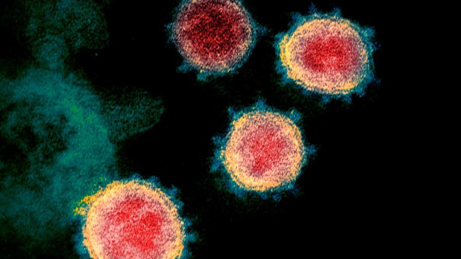 ¿Puedo transmitir el coronavirus después de vacunarme?
