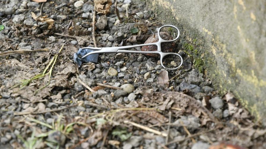 Habrían sido 8 extremidades humanas las que se encontraron en el Mirador Norte Habrían sido 8 extremidades humanas las que se encontraron en el Mirador Norte