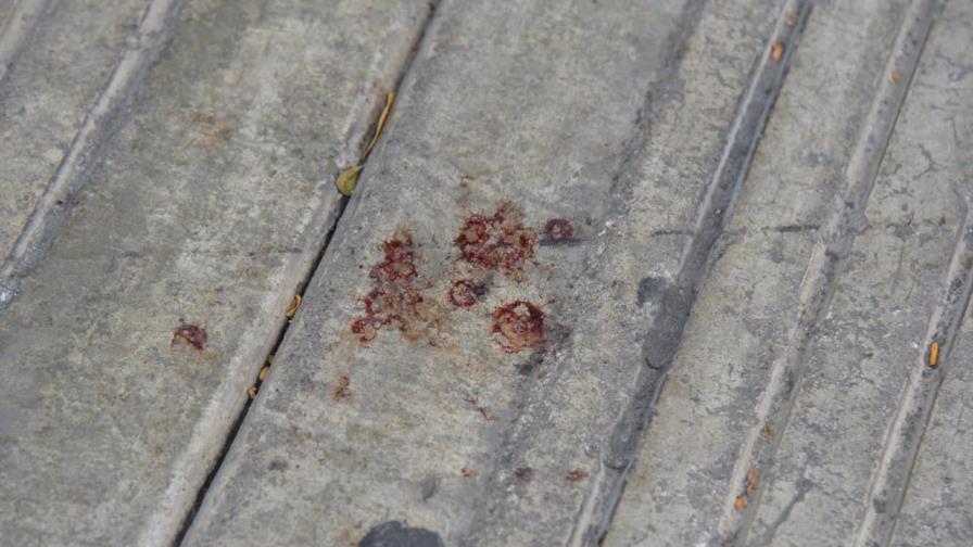 Agentes buscan la bala que atravesó el cuerpo de David Ortíz en bar de SDE
Policía profundiza investigaciones sobre atentado a David Ortíz Agentes buscan la bala que atravesó el cuerpo de David Ortíz en bar de SDE
Policía profundiza investigaciones sobre atentado a David Ortíz