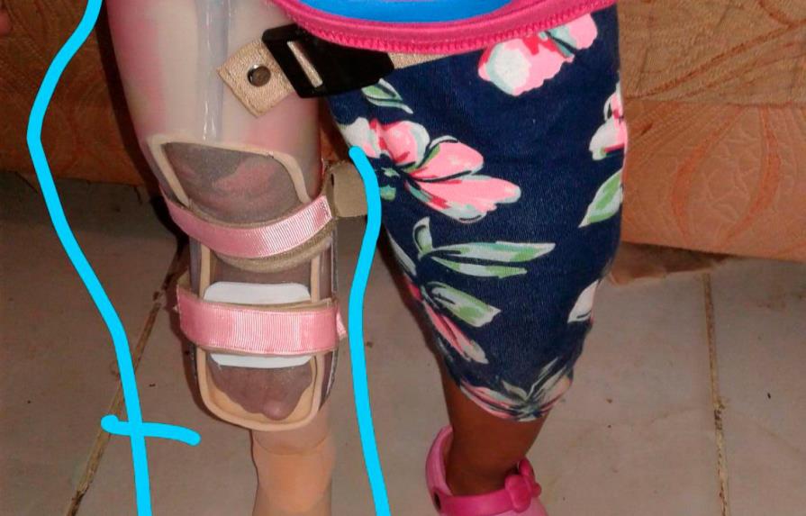 Madre pide ayuda para comprar prótesis a su hija de tres años