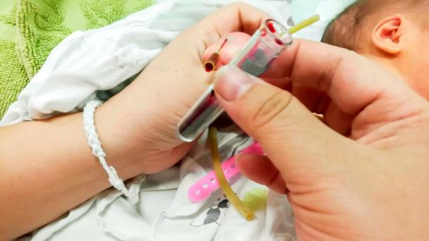 Padres se niegan a realizar transfusión de sangre a su bebé por ser testigos de Jehová