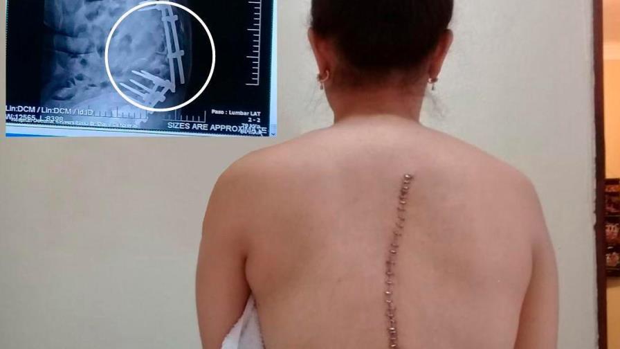 Joven solicita ayuda para someterse a una cirugía Joven solicita ayuda para someterse a una cirugía