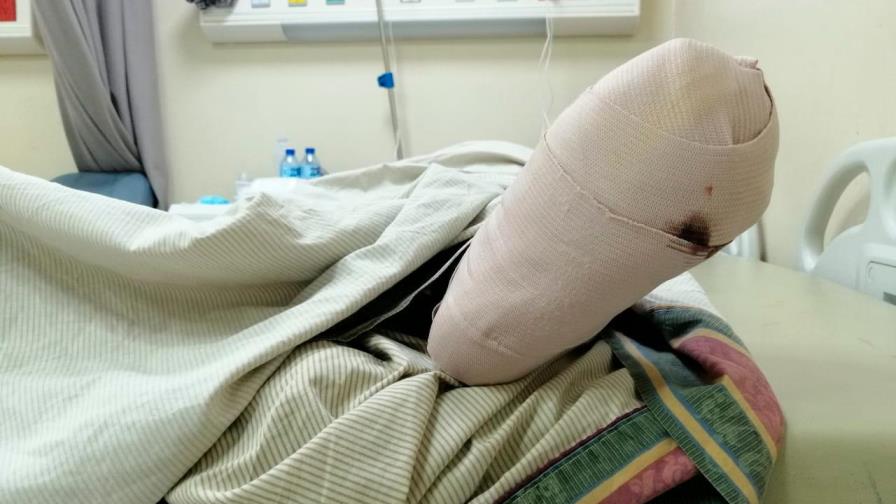 Parientes de pacientes denuncian que la unidad de Pie Diabético del Moscoso Puello no tiene médicos desde el jueves Parientes de pacientes denuncian que la unidad de Pie Diabético del Moscoso Puello no tiene médicos desde el jueves