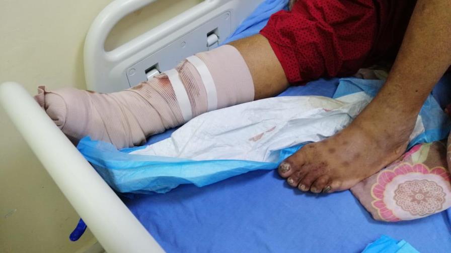 Hospital Moscoso Puello niega denuncia de abandono laboral de médicos Hospital Moscoso Puello niega denuncia de abandono laboral de médicos