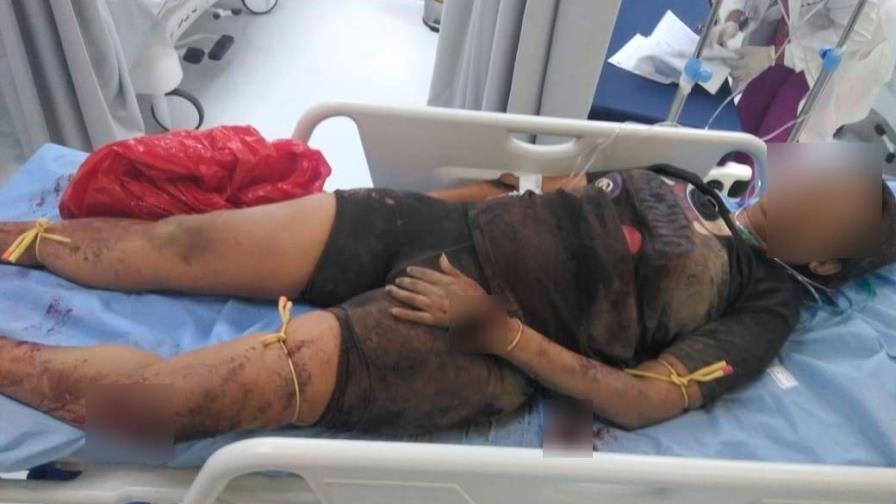 Hombre agrede a machetazos a su esposa en San Juan Hombre agrede a machetazos a su esposa en San Juan