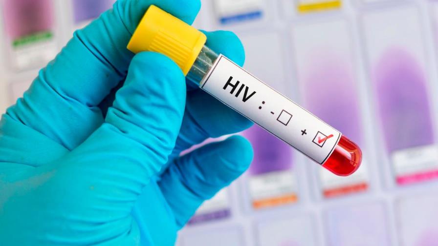 Los médicos confirman la segunda curación del mundo de un paciente con VIH Los médicos confirman la segunda curación del mundo de un paciente con VIH