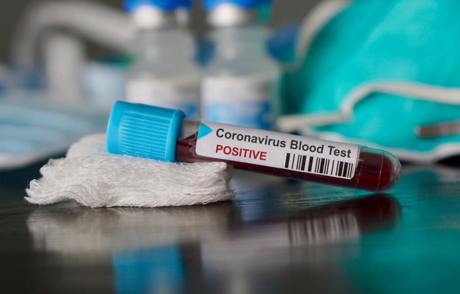 Martes: Coronavirus deja más de 75,000 muertos en el mundo 