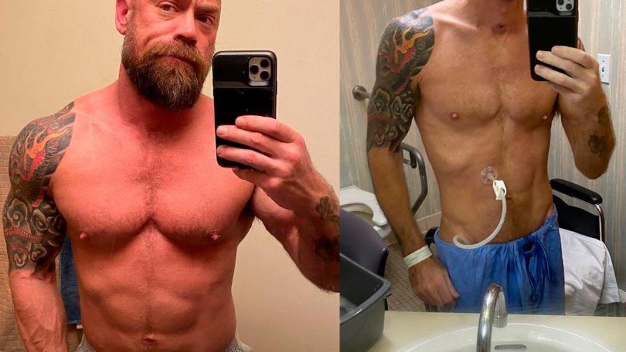 El antes y el después de un paciente con coronavirus El antes y el después de un paciente con coronavirus