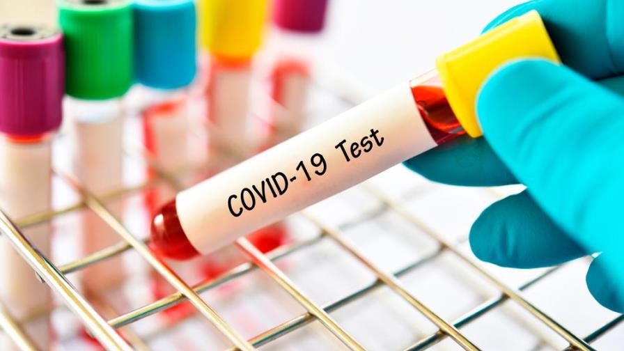 Más de 395,000 muertos en el mundo por coronavirus