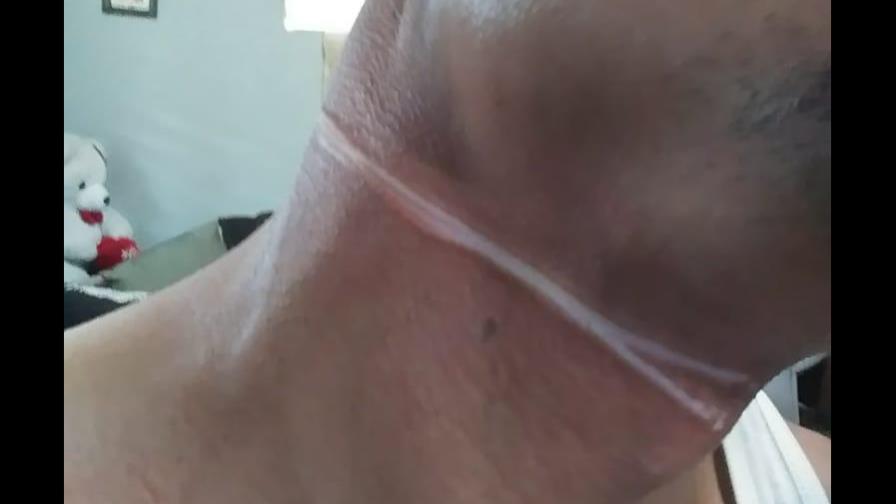 Motorista se enreda con hilo de chichigua y casi pierde la vida 