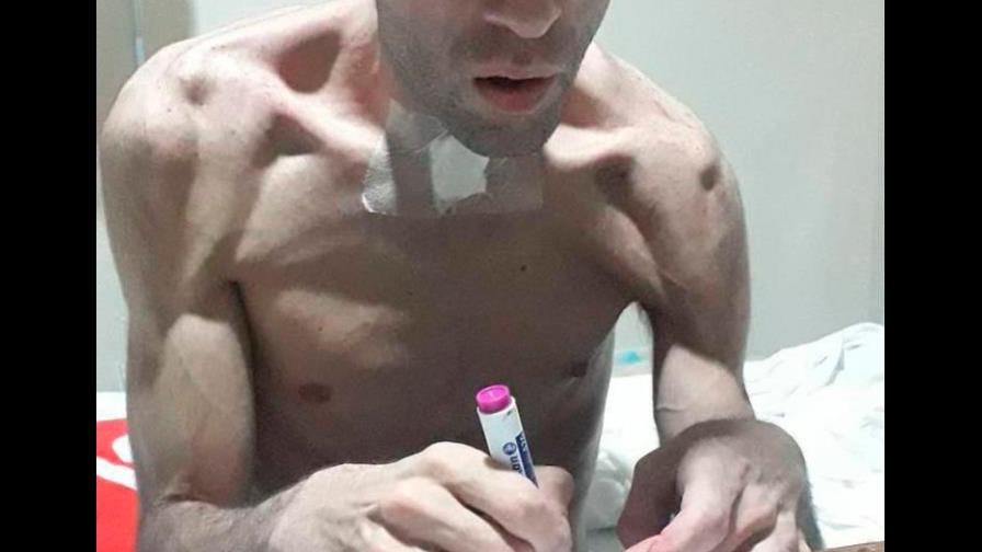 Joven venezolano intoxicado con bebida adulterada presenta leve mejora