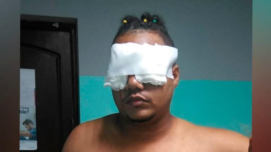 Delincuentes penetran a casa de hombre y le atacan los ojos con una tijera en La Romana
