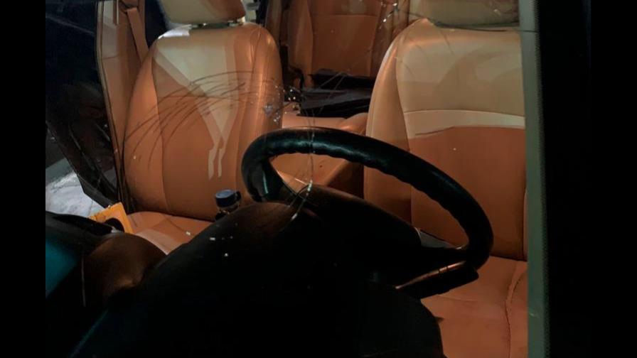 Joven salva su vida milagrosamente tras recibir un disparo en la cabeza durante asalto en SD