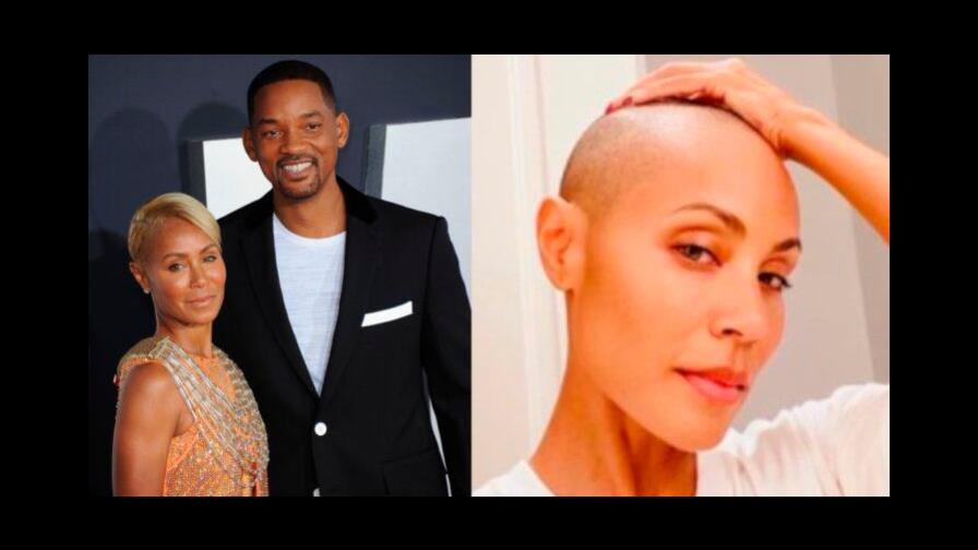 La triste razón por la que Jada Pinkett Smith se rapó la cabeza