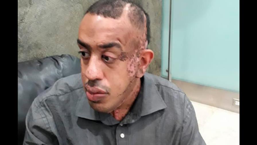 Joven con problemas en la piel pide ayuda para cirugía