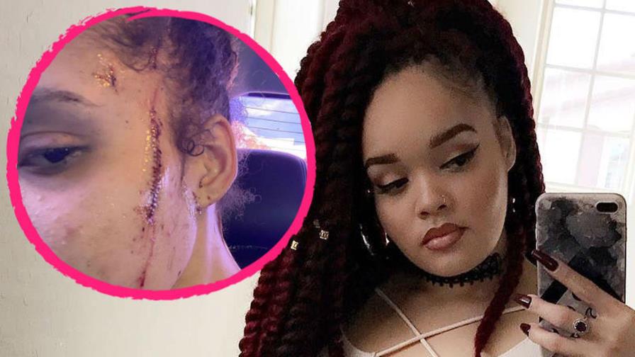 Video | Dan 7 puñaladas a sobrina de Michael Jackson supuestamente por ser negra Video | Dan 7 puñaladas a sobrina de Michael Jackson supuestamente por ser negra