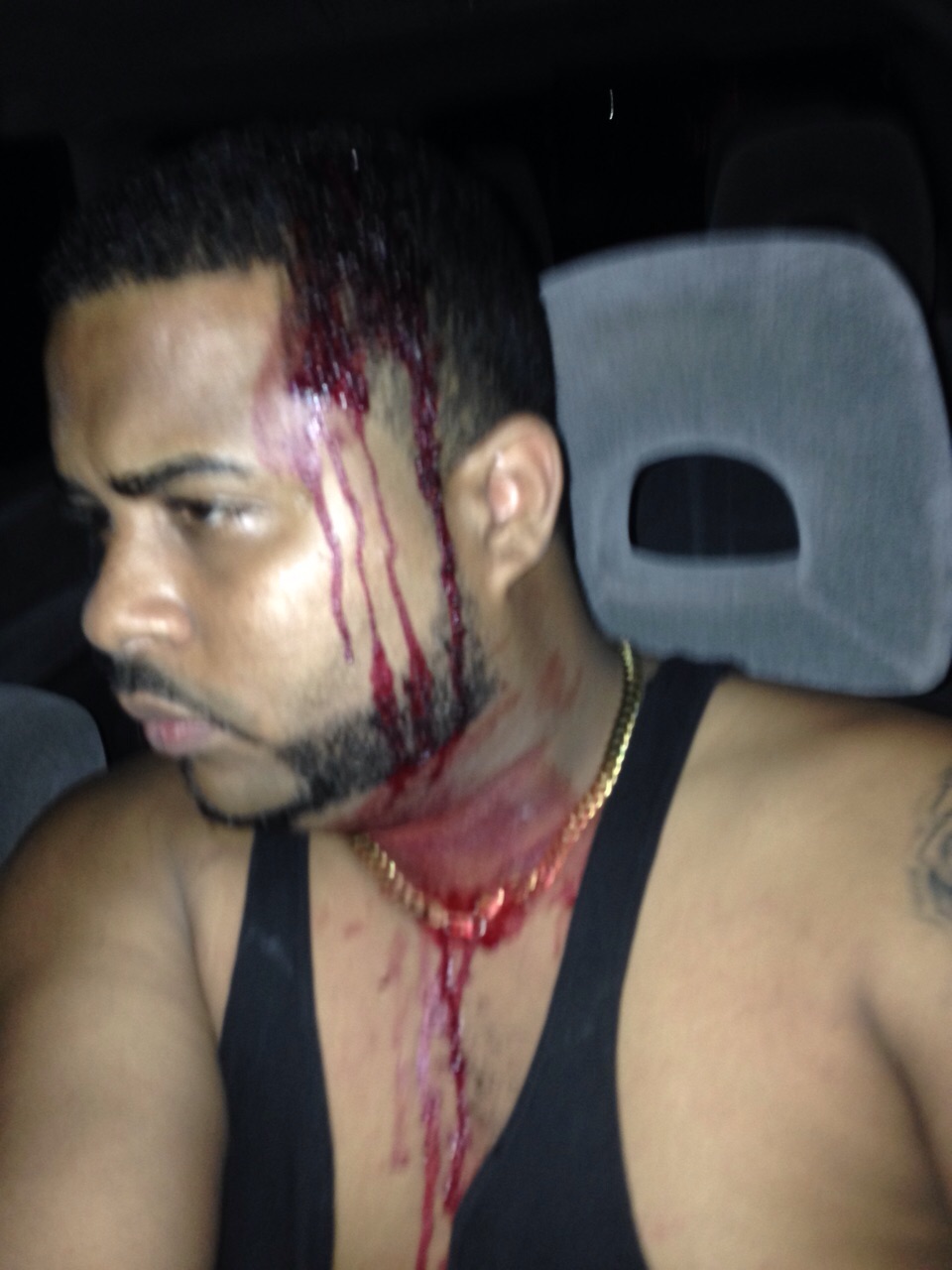 Fotografía suministrada por el presentador de televisión Harinson de Mora de la supuesta golpiza que le habrían dado los agentes de seguridad de Mozart La Para.