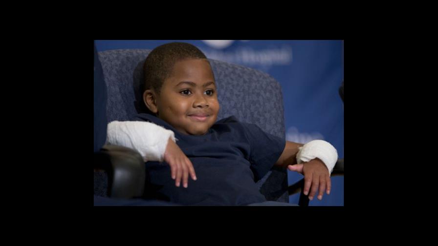 Niño con doble trasplante de mano sale de hospital 