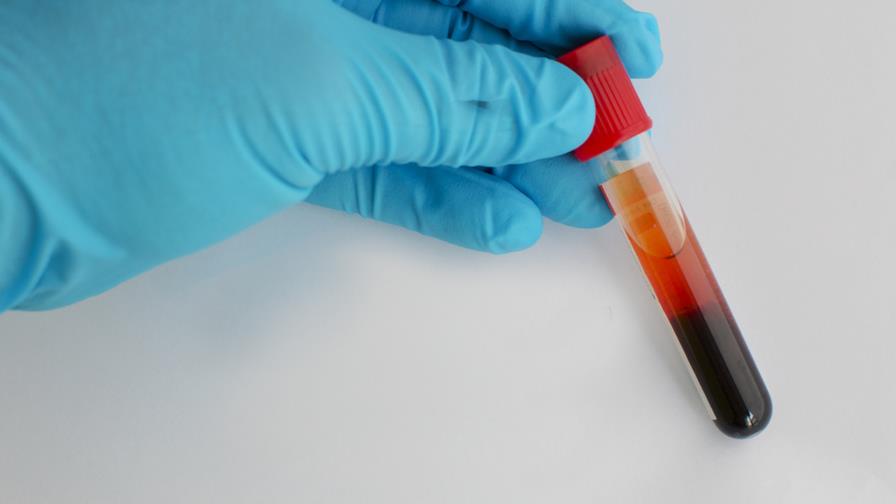 Fondo Mundial aprueba US$ 17.6 millones para prevención y atención del VIH/Sida