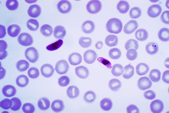 Identifican nuevas variantes genéticas resistentes a la malaria