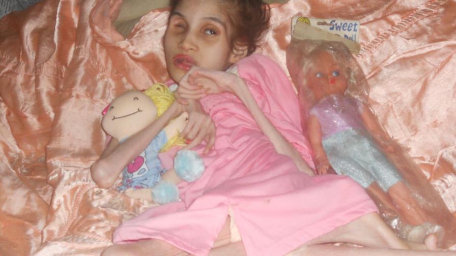 Extrema pobreza y enfermedad desconocida consume joven en Gualey