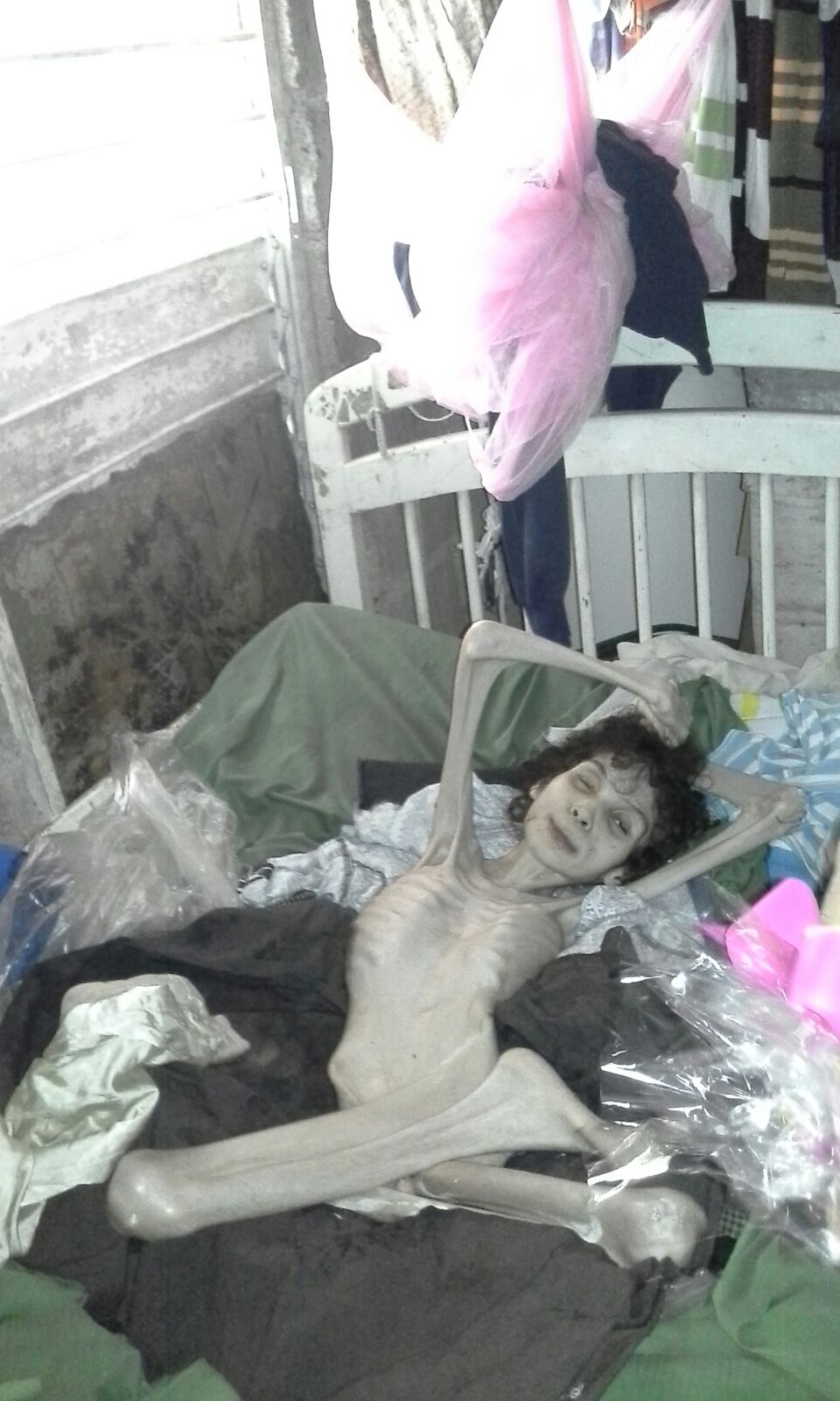 Anaisa antes de recibir ayuda.