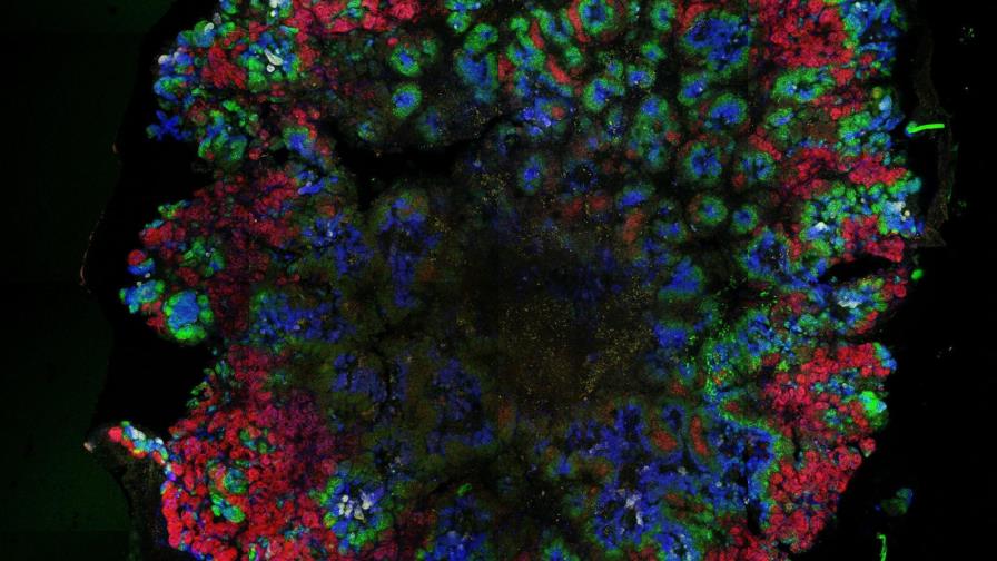 Fabrican estructuras renales embrionarias a partir de células madre humanas