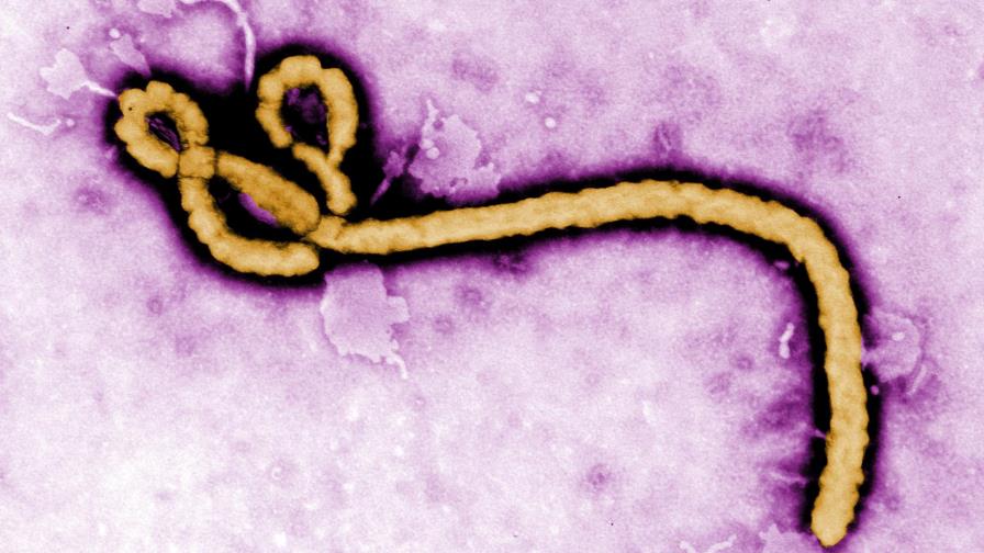 Virus del ébola puede persistir 9 meses en el semen de hombres sobrevivientes 