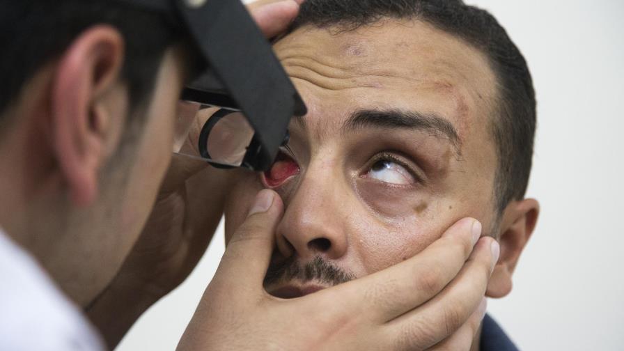 Fabricante de ojos prostéticos ayuda a gazatíes heridos 