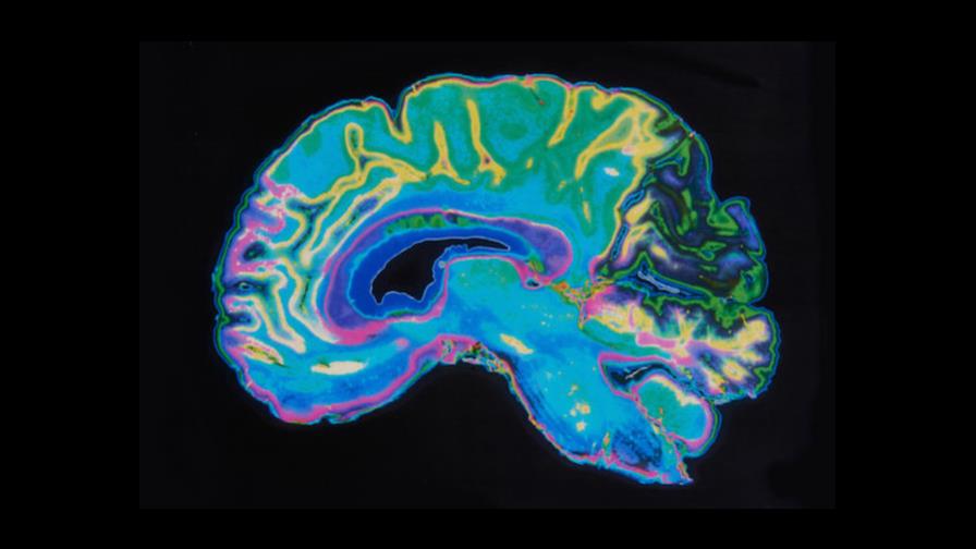 Científicos niegan que pueda hablarse de un cerebro masculino y otro femenino