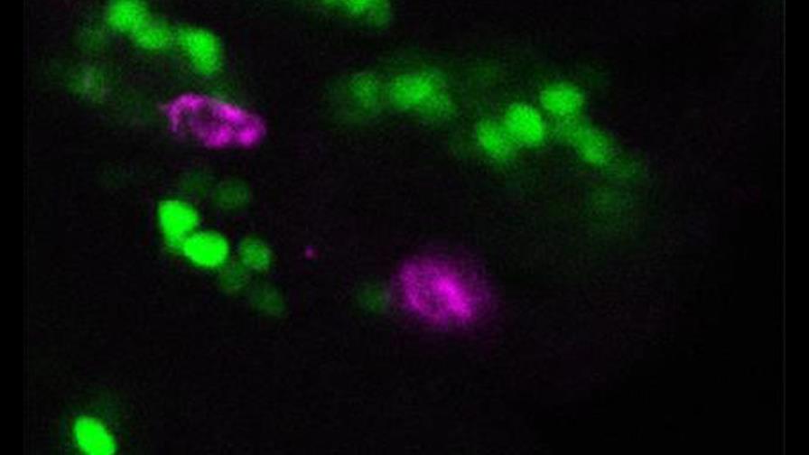 Identifican cómo el organismo elimina a las células “perdedoras”
