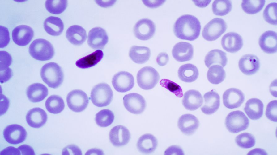 Científicos estudian anticuerpos para crear una vacuna contra la malaria