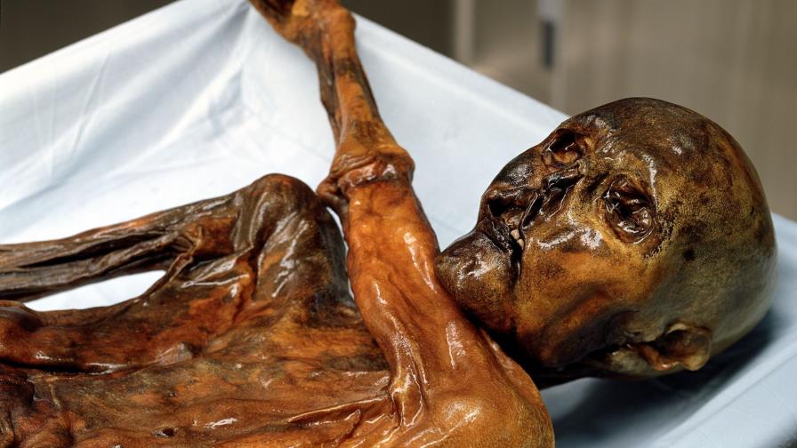 Hallazgo de una bacteria estomacal en la momia Ötzi replantea el Neolítico