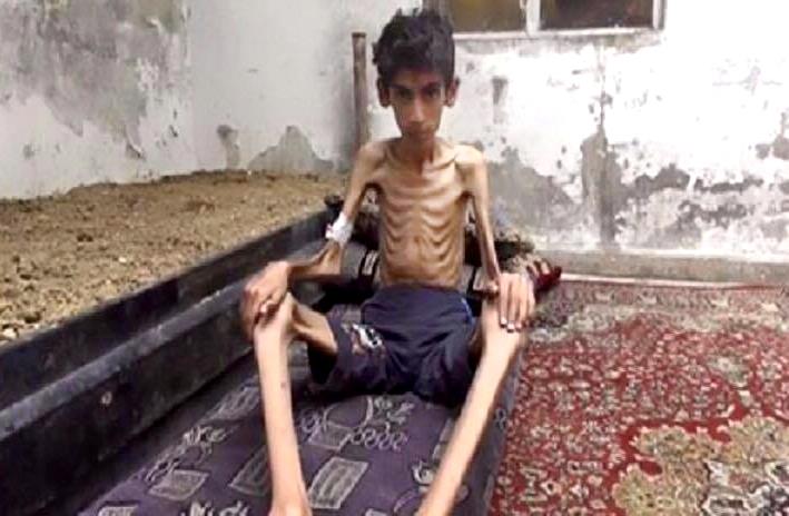 Mueren de hambre 23 personas en la asediada ciudad siria de Madaya