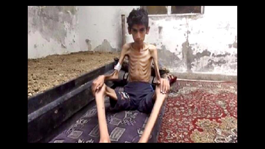 Mueren de hambre 23 personas en la asediada ciudad siria de Madaya