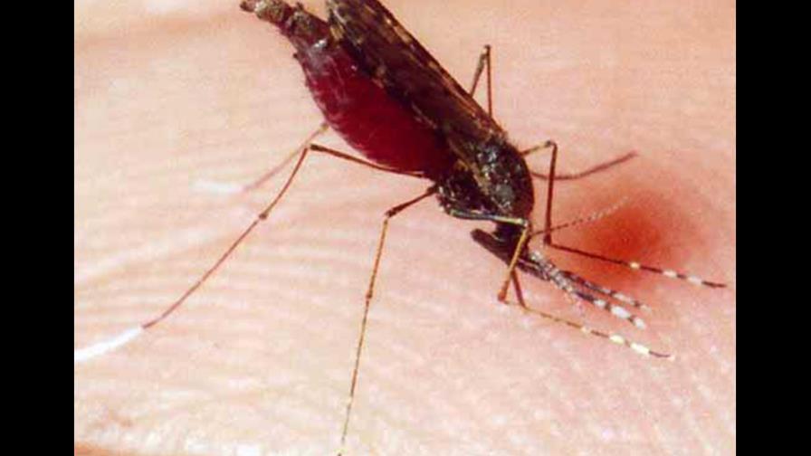 El Salvador no reporta casos de microcefalia por zika 