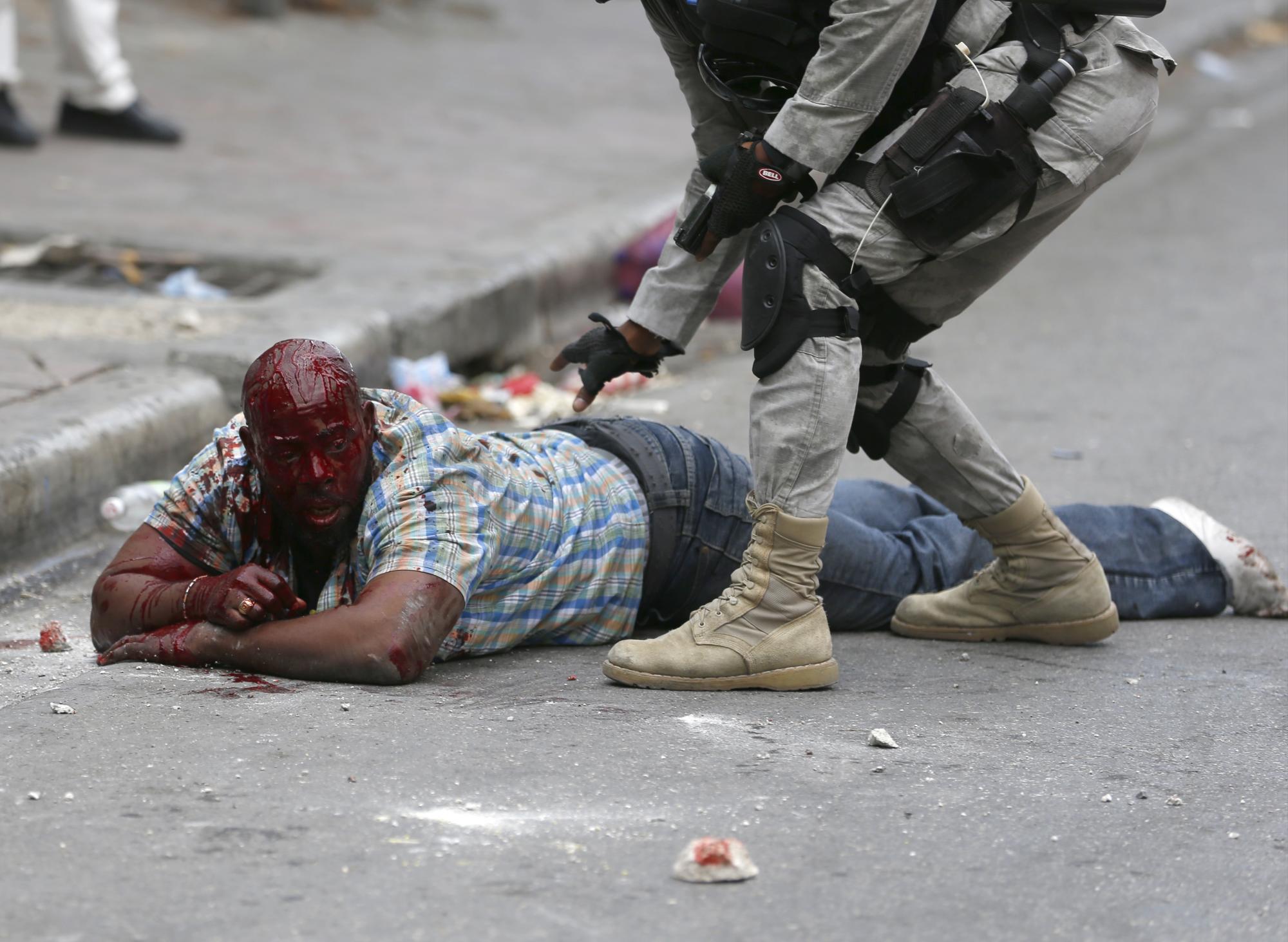 Fotografía de un hombre herido que habría disparado contra los participantes de una manifestación hoy, viernes 22 de enero de 2016, en Puerto Príncipe.