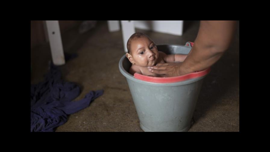 Brasil confirma 270 de 4,180 casos de microcefalia Brasil confirma 270 de 4,180 casos de microcefalia