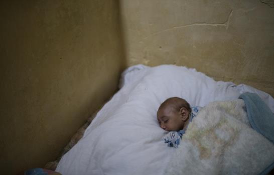 Historia de un bebé brasileño con microcefalia narrada por fotógrafo