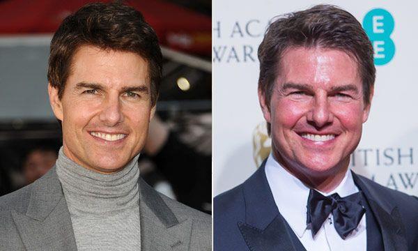 El Nuevo E Inexpresivo Rostro De Tom Cruise Del Que Todos Hablan