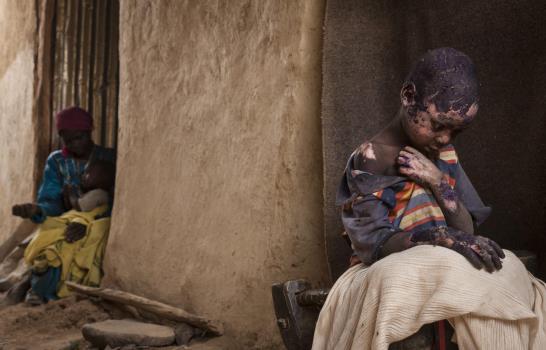 Una foto que escenifica el drama de los refugiados gana el premio World Press